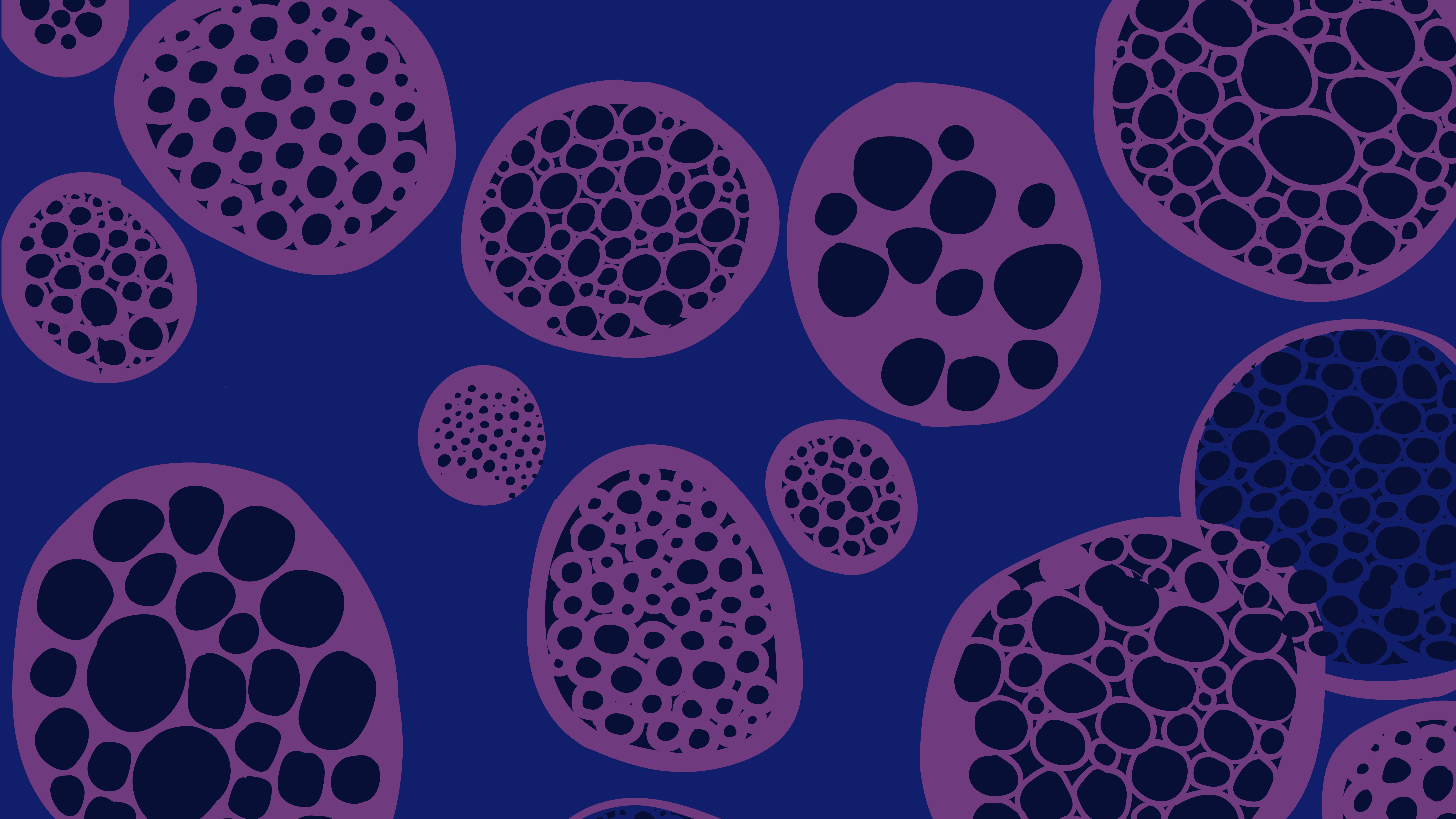 Sarcoidosis 
