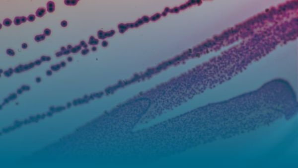 Part 1: A Global Priority: The Fight Against Antimicrobial Resistance