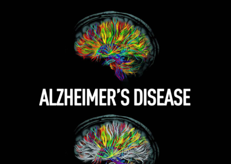 Alzheimer's Disease: A Giving Smarter Guide to Accelerate Development of New Therapies