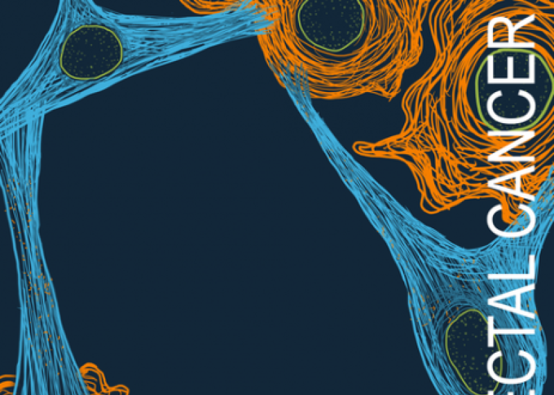 Colorectal Cancer - A Giving Smarter Guide